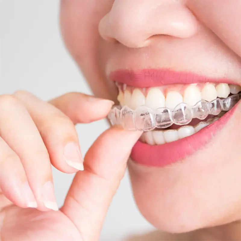 Invisalign