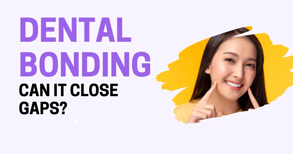 Is Dental Bonding an Effective Solution for Gaps Between Teeth in Midtown?